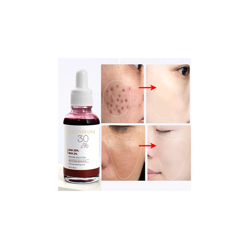 ibspot-26772620